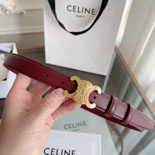 ������ Ʈ������ ���� ��Ʈ   MS8927-4    2.4CM   